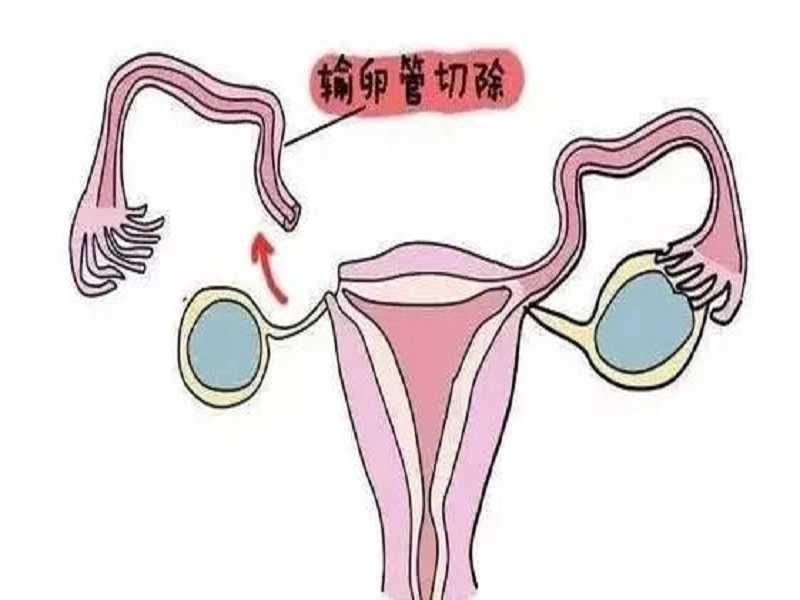 上海哪个医院能做供卵试管婴儿手术好点